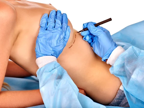 Docteur fait ligne pointillée sur le sein féminin  . — Photo