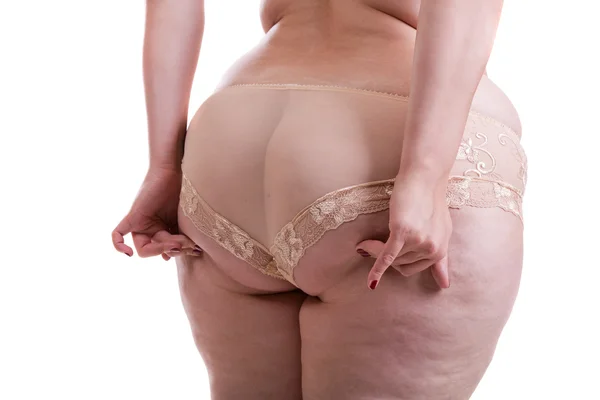 臀部的女人病人脂肪 — 图库照片